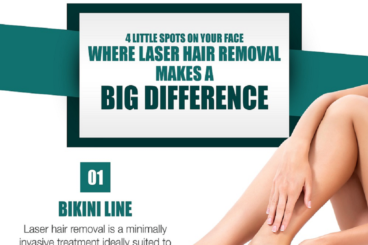 4 Little Spots on Your Face Where Laser Hair Removal Makes a Big Difference [Infographic]