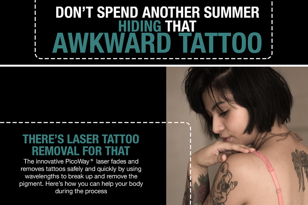 Don’t Spend Another Summer Hiding that Awkward Tattoo [Infographic]