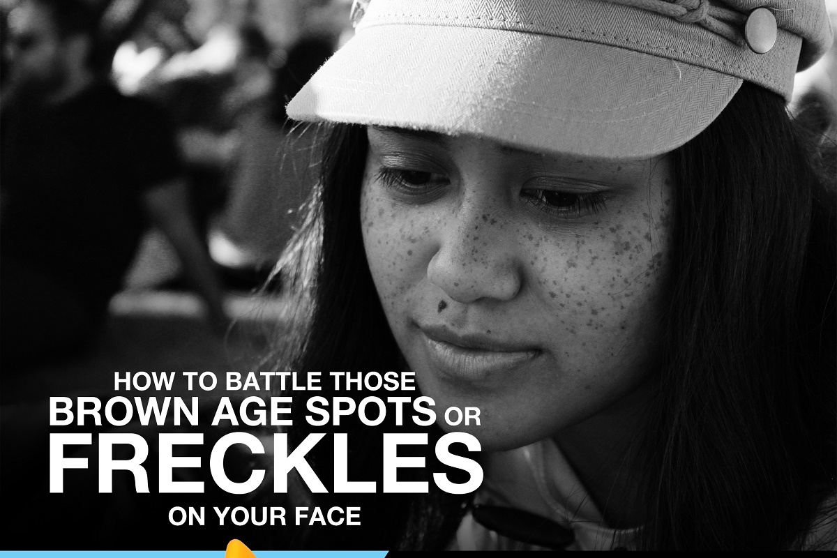 How to Battle those Brown Age Spots or Freckles on Your Face [Infographic]