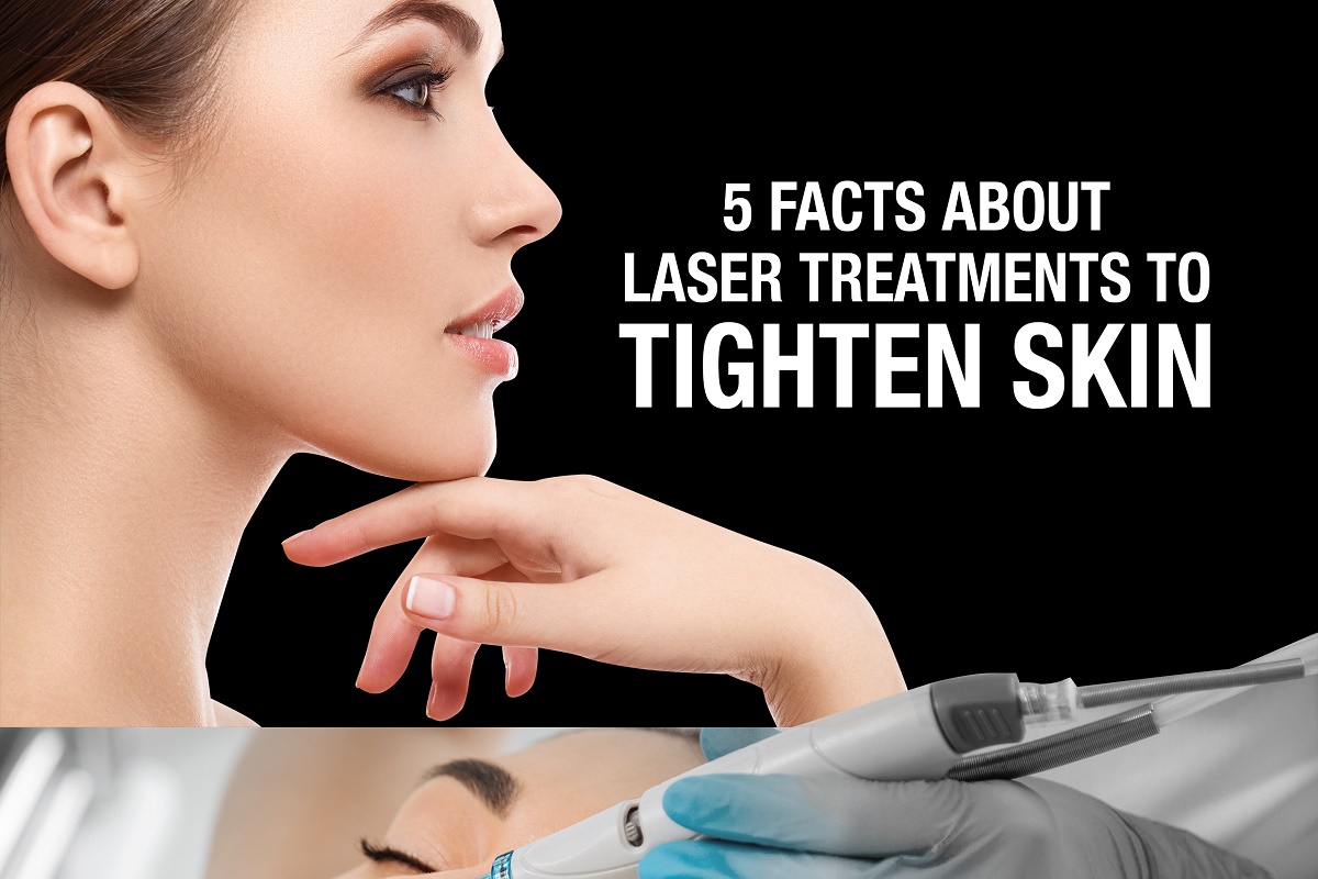 5 Facts About Laser Treatments To Tighten Skin [Infographic]