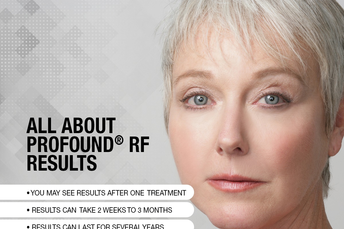 All About Profound® RF Results [Infographic]